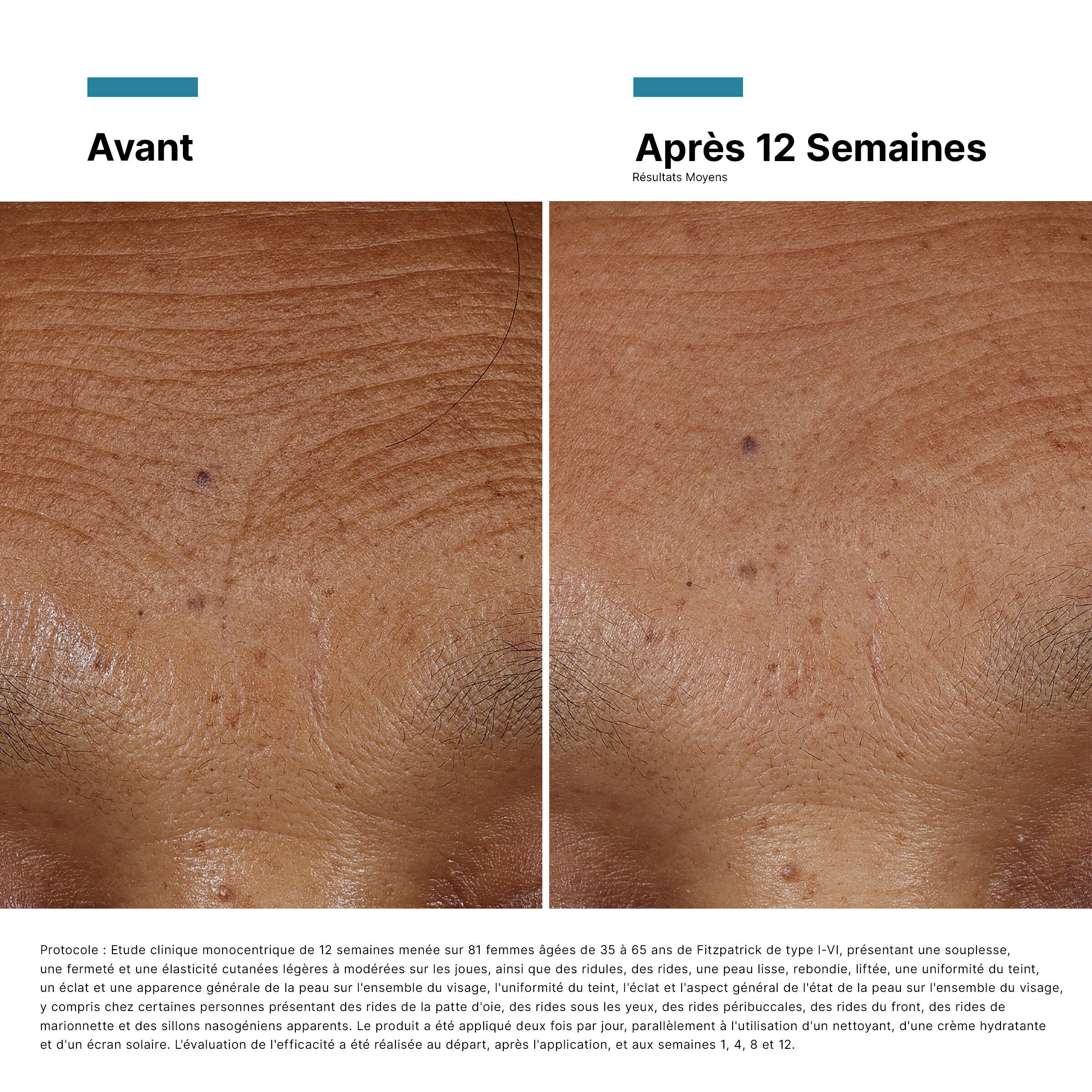 HA Intensifier Multi-Glycan
