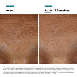 HA Intensifier Multi-Glycan