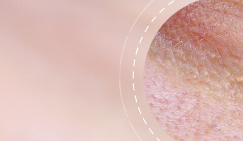Close-up of skin texture showing fine lines and uneven tone against a soft pink background.