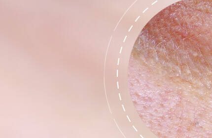 Close-up of skin texture showing fine lines and uneven tone against a soft pink background.