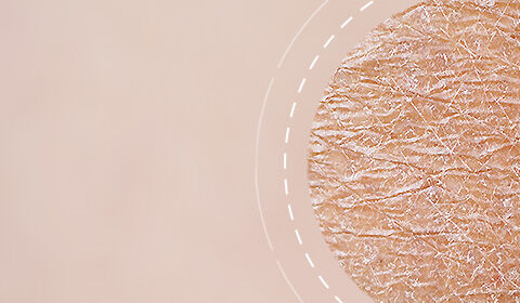 Close-up of textured skin with visible fine lines and a soft, neutral background.