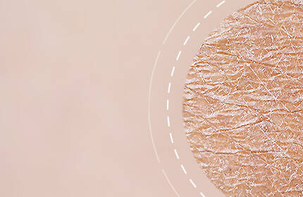 Close-up of textured skin with visible fine lines and a soft, neutral background.