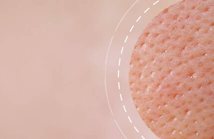 Close-up of textured skin, highlighting pores and surface details against a soft, blurred background.