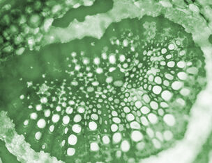 Detail de la coupe microscopique d'une plante, montrant des cellules vertes disposees en motifs circulaires.