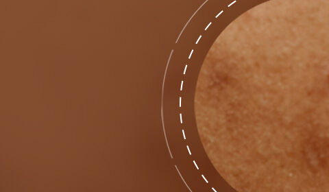 Close-up of textured skin with a warm brown background, featuring subtle blemishes and natural variations in tone.