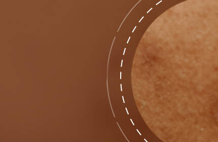 Close-up of textured skin with a warm brown background, featuring subtle blemishes and natural variations in tone.