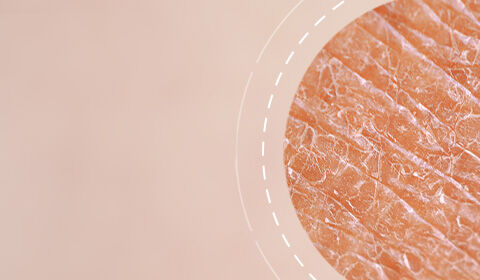 Close-up view of textured skin, with a soft, light background and a circular inset highlighting the skin's surface details.