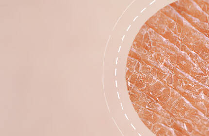 Close-up view of textured skin, with a soft, light background and a circular inset highlighting the skin's surface details.