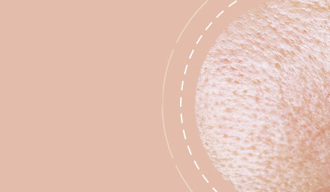 Close-up view of a textured skin surface with a soft, neutral background.