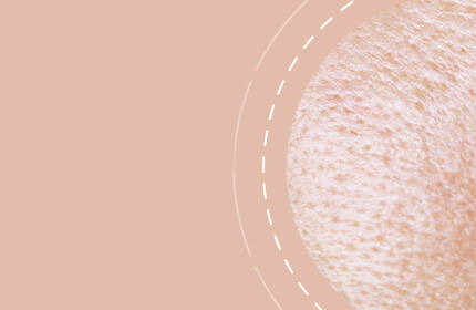 Close-up view of a textured skin surface with a soft, neutral background.