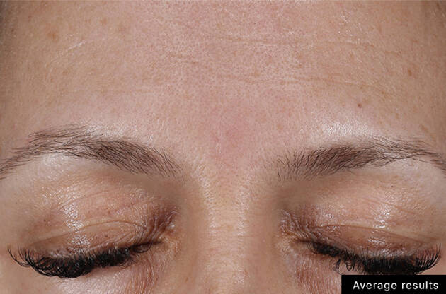 Une vue rapprochee d'un front feminin avec des sourcils fins et des cils longs, montrant une peau claire et legere.