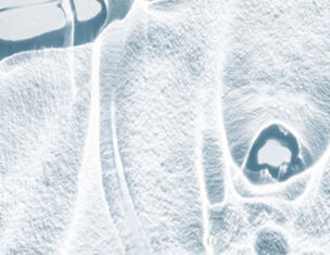 Close-up of an abstract, icy surface with intricate patterns and textures, resembling frost or frozen water.