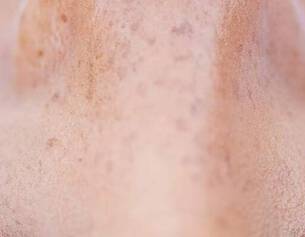 Close-up van een gezicht met zichtbare freckels en lange wimpers, gefocust op de neus en ogen.