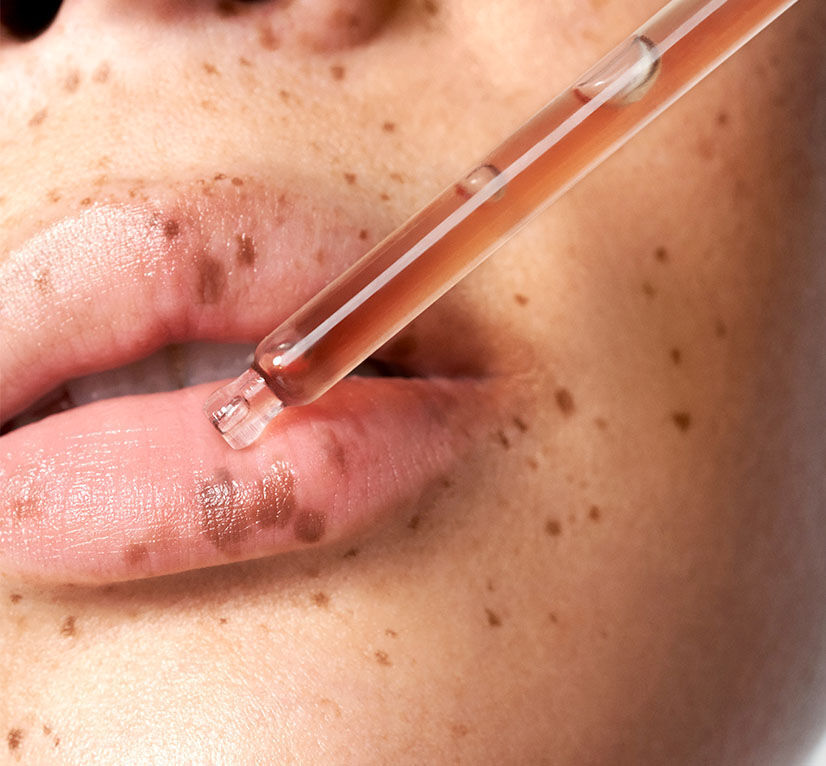 Corrective moisturizers