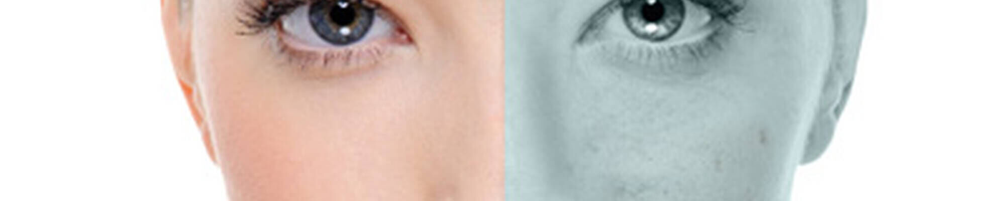 Visage feminin illustrant la depigmentation.