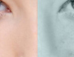 Visage feminin illustrant la depigmentation.